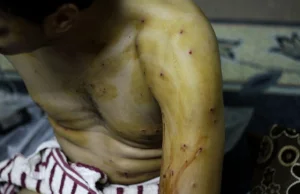 Gwałtowne rozruchy w Bahrajnie; rany na całym ciele, tak "urządziła" go policja