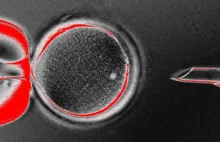 Klonowanie zarodka człowieka - udało się?