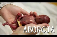 Aborcja - za czy przeciw? 4 minuty faktów!