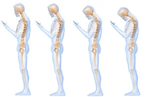 Smartfony szkodliwe dla kręgosłupa [ENG]