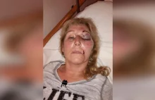 Niemcy: Kobieta brutalnie pobita w Nowy Rok. Oprawca miał arabski wygląd
