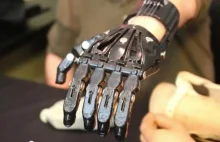 Amerykanin porównuje protezę za $42000 do wydrukowanej w 3d ręki cyborga za $50