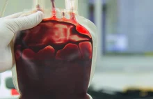Jak przetoczenie krwi od młodszej osoby może odnowić stary mózg [Ang]