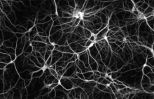 Badacze odkryli nowy rodzaj neuronów o istnieniu których nawet nie podejrzewano