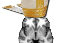 The Case of the Bishop's Brain - Neuroskeptic
