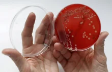 Opracowano nowe sposoby walki z bakteriami odpornymi na antybiotyki