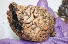 Odcięta głowa zawierała najstarszy odnaleziony mózg