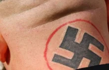 Za darmo pomaga pozbyć się rasistowskich tatuaży