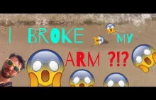 I BROKE my arm ?!? Bulgarian Adventure [ENG SUB
