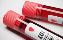 Nowe badanie krwi z 83% skutecznością określia czy umrzemy w ciągu 10 lat