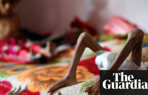 Jemen: najwieksza klęska głodu w nowoczesnej historii ludzkości