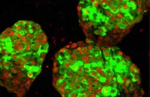 Naukowcom udało się zamienić komórki macierzyste w komórki produkujące insulinę.