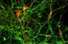 Wstrzyknięcie iPSC do mózgu może pomóc w chorobie Parkinsona