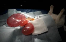 Operacja królika - wodomacicze i zapiaszczenie układu moczowego