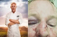Znany kucharz w Szwecji został pobity dlatego, że był podobny do Trumpa