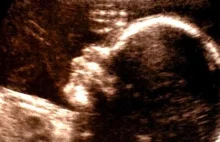 Nie-ludzki płód. Tekst, którego wystraszył się miesięcznik "Znak"