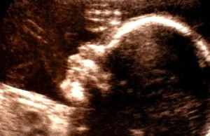 Nie-ludzki płód. Tekst, którego wystraszył się miesięcznik "Znak"