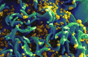Naukowcy usunęli HIV z ludzkich komórek T