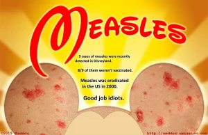 [EN] Measles was eradicated in the US in 2000. Now it's back at the Wonderful...