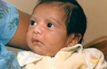 Ślepy zaułek medycyny: niemowlak z sercem od pawiana