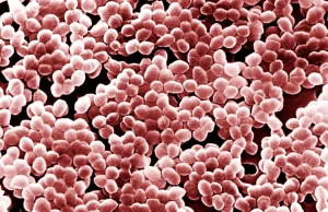 Odkryto przyczynę lekooporności jednej z bakterii odpowiedzialnych za sepsę