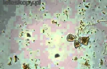 Kropla wody pod mikroskopem.