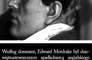 Edward Mordrake - człowiek o dwóch twarzach