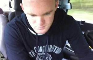 Wayne Rooney po przeszczepieniu włosów - zdjęcie