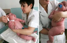 250-kilogramowa kobieta urodziła ważące 18 kg dziecko