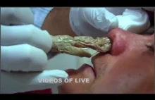 Best Video People Removing nose packing Compilation