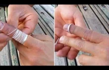 Jak zdjąć zblokowaną obrączkę z palca?