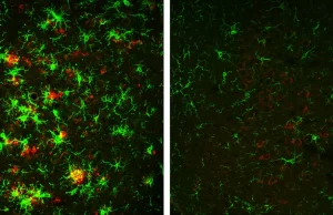 Naukowcy nie tylko POWSTRZYMALI, ale ODWRÓCILI skutki ALZHEIMERA u myszy