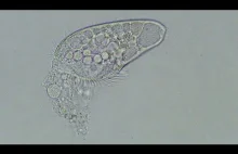 Śmierć organizmu jednokomórkowego (wideo)
