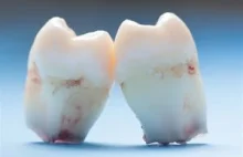 Medycyna znalazła sposób na wyhodowanie zębów. Pożegnanie z dentystą?