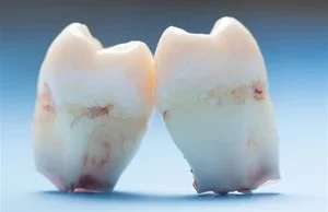 Medycyna znalazła sposób na wyhodowanie zębów. Pożegnanie z dentystą?
