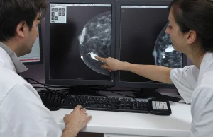 Sztuczna inteligencja wykrywa raka piersi lepiej niż lekarze