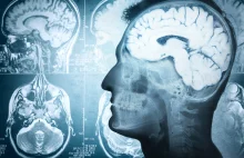 Mózg człowieka – jak dbać i czym go karmić? | Ziołolecznictwo i zdrowie