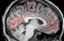 Pierwsze nagranie "prania mózgu" zarejestrowane przez naukowców