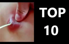 TOP 10 Viewed Video (November) "All pimples channel"