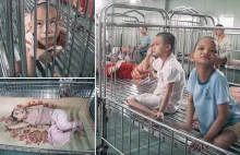 Zdeformowane dzieci w Wietnamie