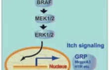 Odkryto szlak sygnalizacyjny odpowiedzialny za indukowanie i rozwój swędzenia