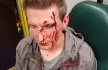 Leon Redlinski pobity przez grupę agresywnych nastolatków w Dublinie