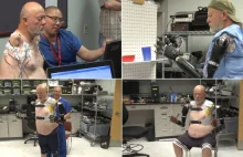 Bioniczne ramiona mogą zastąpić amputowane. Przełom w protetyce?