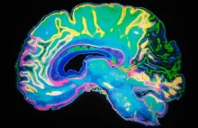 Naukowcy odnaleźli substancję, która skutecznie walczy z chorobą Alzheimera