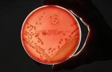 1000-letnia mikstura z cebuli czosnku i żółci skuteczna w walce z bakteriami