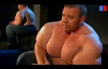 Top 7 Synthol Freaks